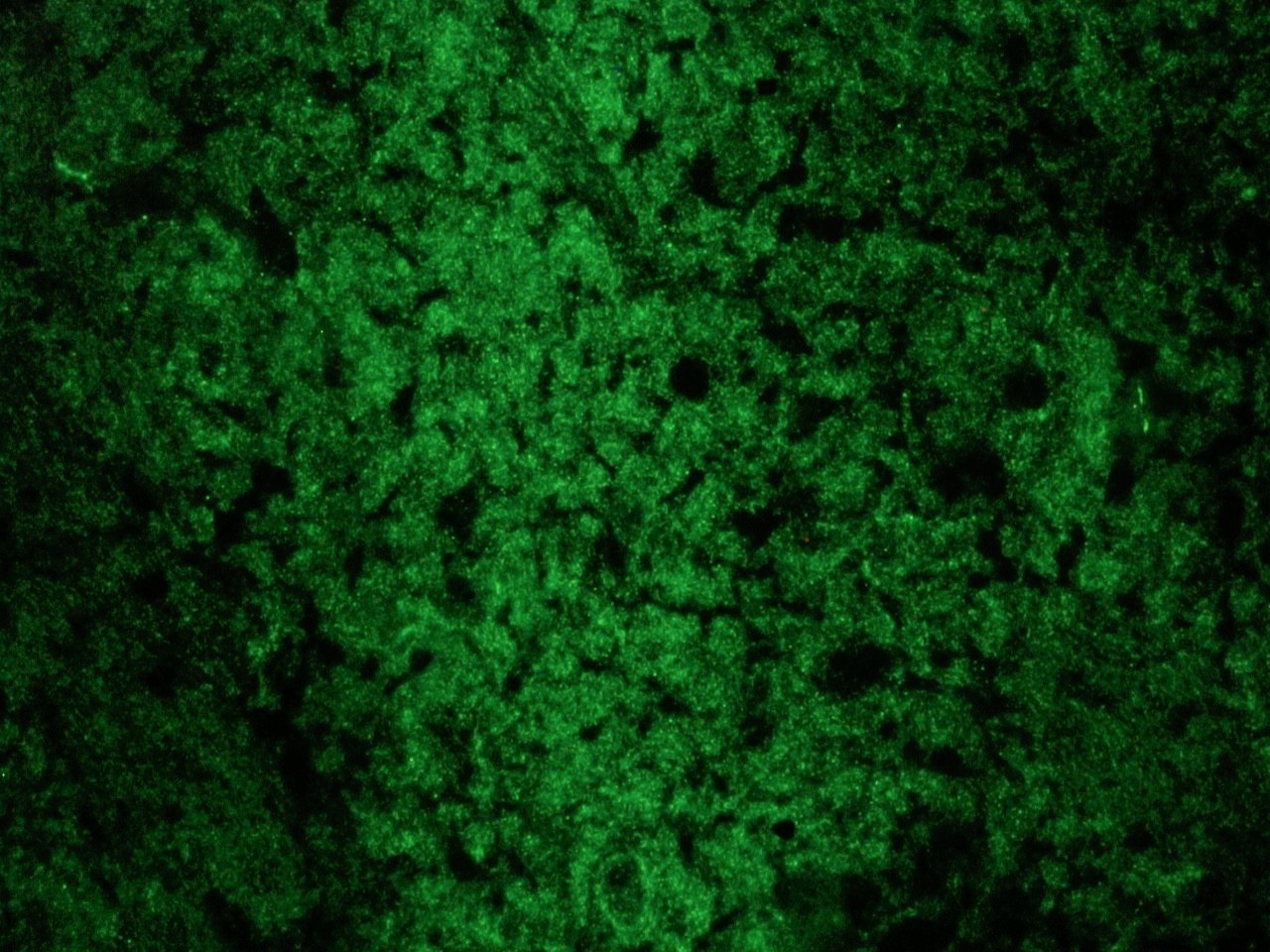 Figure 1. Indirect immunofluorescence staining of reticulon-1A/NSP-A in rat brain frozen section using MUB1312P (clone MON162) at a 1:500 dilution.